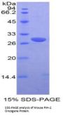 Mouse Pim-2 Oncogene (PIM2) Protein