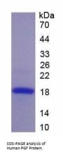 Human Placenta Growth Factor (PLGF) Protein
