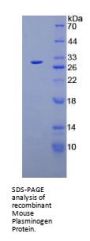 Mouse Plasminogen (PLG) Protein