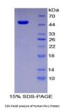 Human Plasminogen Activator Inhibitor 1 (PAI1) Protein