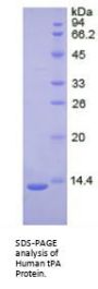 Human Plasminogen Activator, Tissue (tPA) Protein
