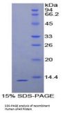 Human Plasminogen Activator, Urokinase Receptor (uPAR) Protein
