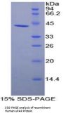 Human Plasminogen Activator, Urokinase Receptor (uPAR) Protein