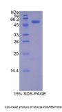 Mouse Platelet Derived Growth Factor BB (PDGFBB) Protein