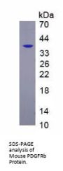 Mouse Platelet Derived Growth Factor Receptor Beta (PDGFRB) Protein