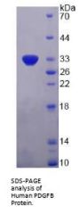 Human Platelet Derived Growth Factor Subunit B (PDGFB) Protein