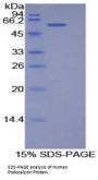 Human Podocalyxin (PODXL) Protein