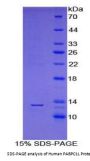 Human Poly A Binding Protein Cytoplasmic 1 Like Protein (PABPC1L) Protein