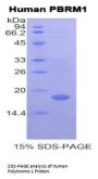 Human Polybromo 1 (PBRM1) Protein