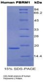 Human Polybromo 1 (PBRM1) Protein