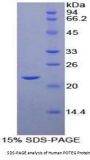 Human POTE Ankyrin Domain Family, Member G (POTEG) Protein