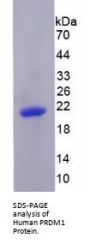 Human PR Domain Containing Protein 1 (PRDM1) Protein