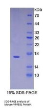 Mouse Pre-B-Lymphocyte Gene 1 (VPREB1) Protein