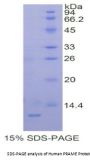 Human Melanoma Antigen Preferentially Expressed In Tumors (PRAME) Protein