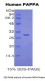 Human Pregnancy Associated Plasma Protein A (PAPPA) Protein