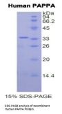 Human Pregnancy Associated Plasma Protein A (PAPPA) Protein