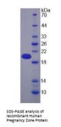 Human Pregnancy Zone Protein (PZP) Protein