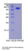 Rat Pregnancy Zone Protein (PZP) Protein