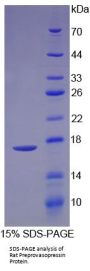 Rat Vasopressin-Neurophysin 2-Copeptin (AVP) Protein