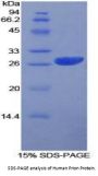 Human Prion Protein (PRNP) Protein