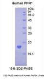 Human Profilin 1 (PFN1) Protein