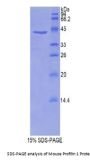 Mouse Profilin 1 (PFN1) Protein