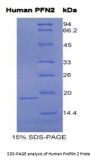 Human Profilin 2 (PFN2) Protein