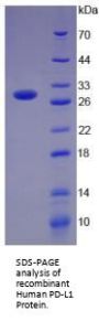 Human Programmed Cell Death 1 Ligand 1 (CD274) Protein