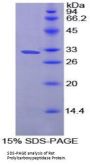 Rat Prolylcarboxypeptidase (PRCP) Protein