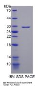 Human Promyelocytic Leukemia Protein (PML) Protein