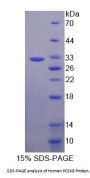 Human Proprotein Convertase Subtilisin/Kexin Type 9 (PCSK9) Protein