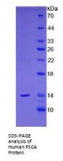 Human Prostate Stem Cell Antigen (PSCA) Protein