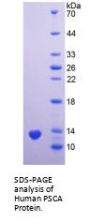Human Prostate Stem Cell Antigen (PSCA) Protein