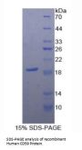 Human CD59 Glycoprotein (CD59) Protein