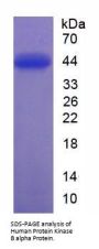 Human Protein Kinase B Alpha (PKBa) Protein