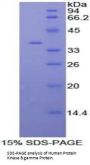 Human Protein Kinase B Gamma (PKBg) Protein