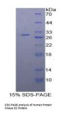 Human Serine/Threonine-Protein Kinase D2 (PRKD2) Protein