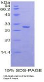 Rat Protein Kinase R (PKR) Protein