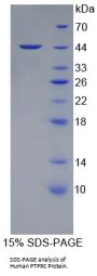 Human Receptor-Type Tyrosine-Protein Phosphatase C / CD45 (PTPRC) Protein