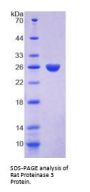Rat Proteinase 3 (PRTN3) Protein