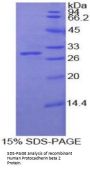 Human Protocadherin Beta 2 (PCDHb2) Protein