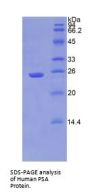 Human Puromycin Sensitive Aminopeptidase (PSA) Protein
