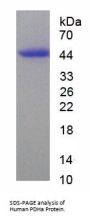 Human Pyruvate Dehydrogenase Alpha (PDHa) Protein