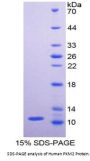 Human Pyruvate Kinase, Muscle (PKM2) Protein
