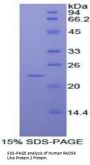 Human RAD54 Like Protein 2 (RAD54L2) Protein
