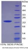 Human Tumor Necrosis Factor Ligand Superfamily Member 11 (TNFSF11) Protein