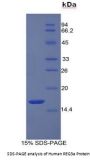 Human Regenerating Islet Derived Protein 3 Alpha (REG3a) Protein