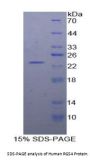 Human Regulator Of G Protein Signaling 4 (RGS4) Protein