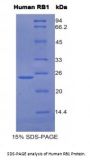 Human Retinoblastoma Protein 1 (RB1) Protein