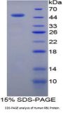 Human Retinoblastoma Protein 1 (RB1) Protein